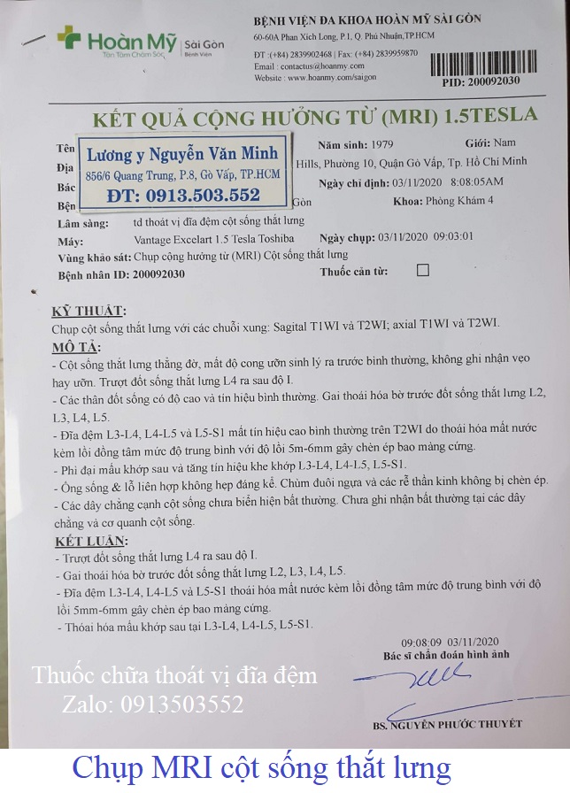 Chụp MRI ở bệnh viện Hoàn Mỹ Sài Gòn